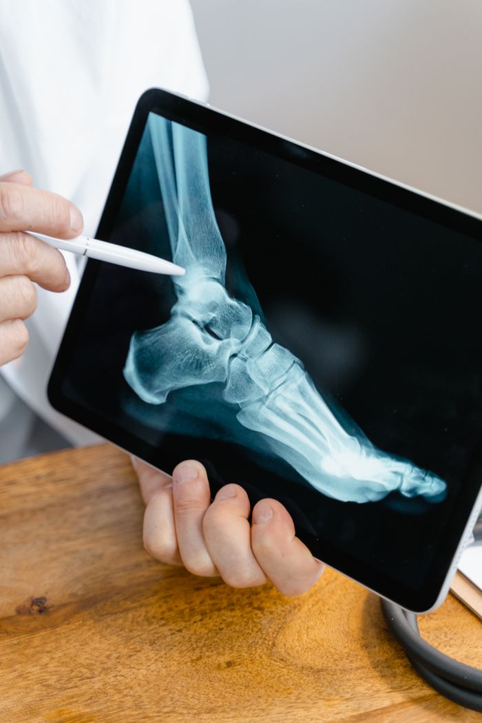 gallery-03 Close-up of a doctor examining a foot x-ray on a tablet, using a stylus for demonstration.
